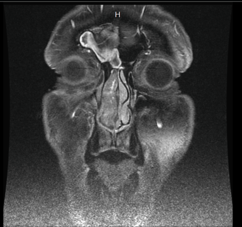 MRI front-looking scan - 2011.04.19