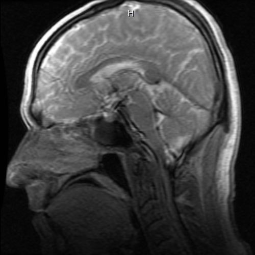 MRI Side-looking scan 2011.04.19
